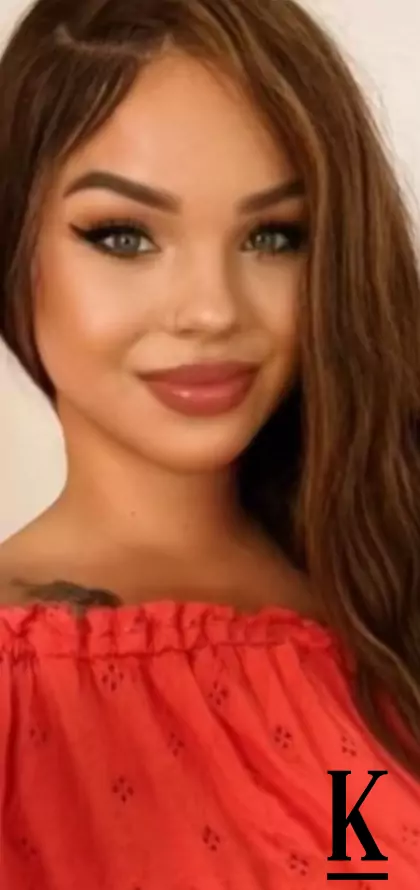 stories-slider-content