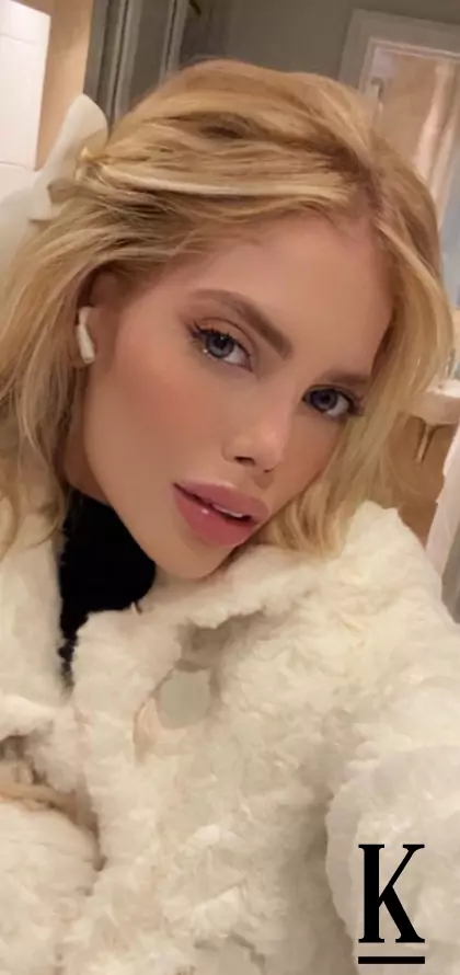 stories-slider-content