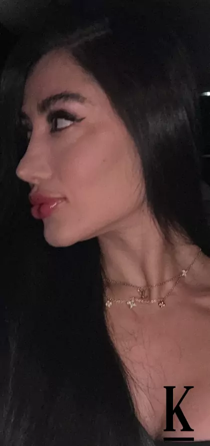 stories-slider-content