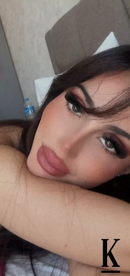 stories-slider-content