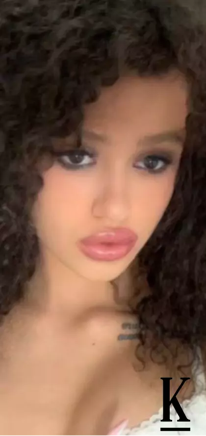 stories-slider-content