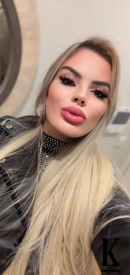 stories-slider-content