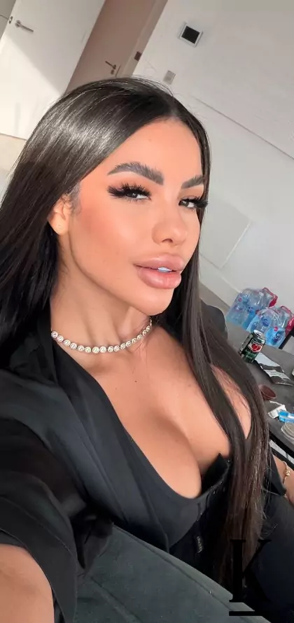 stories-slider-content