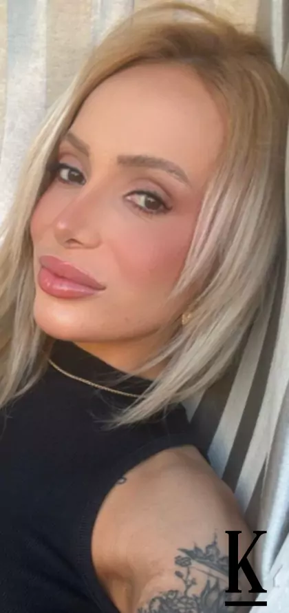 stories-slider-content